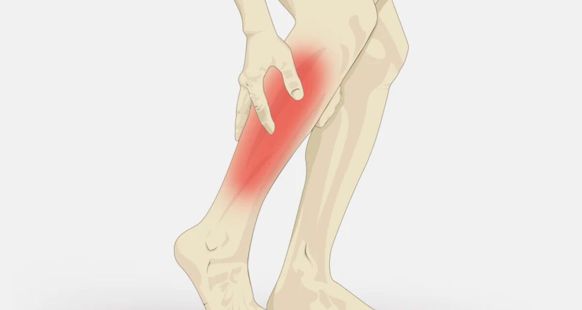 Muscle Cramps: Symptoms, Causes, Diagnosis, and Treatment