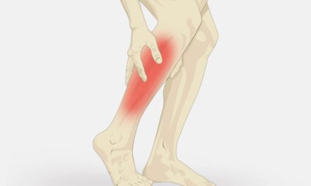 Muscle Cramps: Symptoms, Causes, Diagnosis, and Treatment