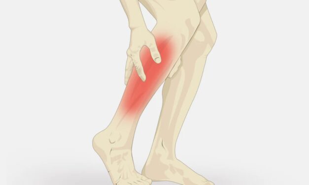 Muscle Cramps: Symptoms, Causes, Diagnosis, and Treatment