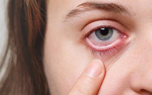 Common Eye Problems & Their Symptoms