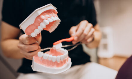 Clear Guide to Artificial Teeth for Our Community