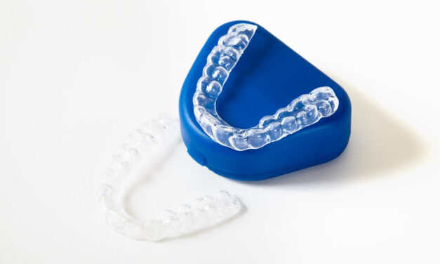 Now Make an Informed Decision After Knowing All About Aligners Price in India